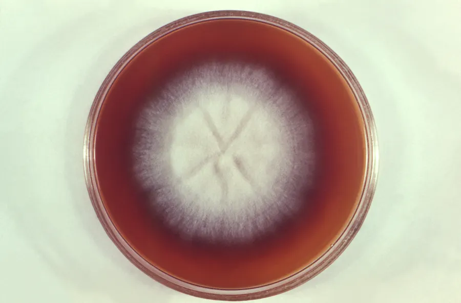 Dokumentasi Microsporum gallinae — Fotografi