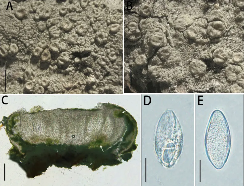 Dokumentasi Ochrolechia longispora — Pelat ilmiah