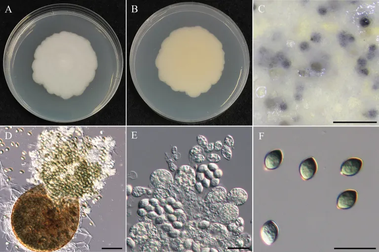 Dokumentasi Pseudothielavia terricola — Pelat ilmiah