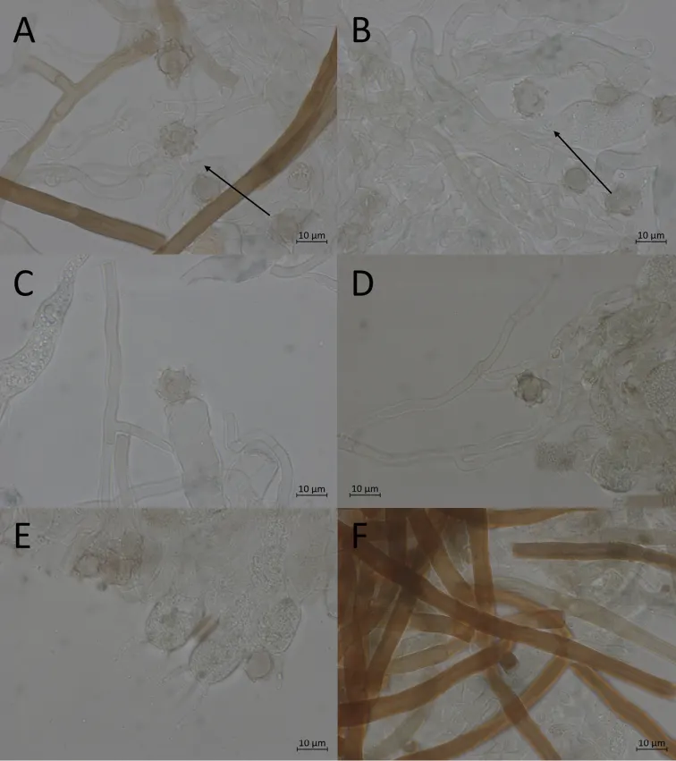 Dokumentasi Pseudotomentella longisterigmata — Pelat ilmiah