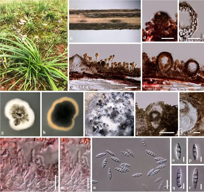 Dokumentasi Sphaerellopsis paraphysata — Pelat ilmiah