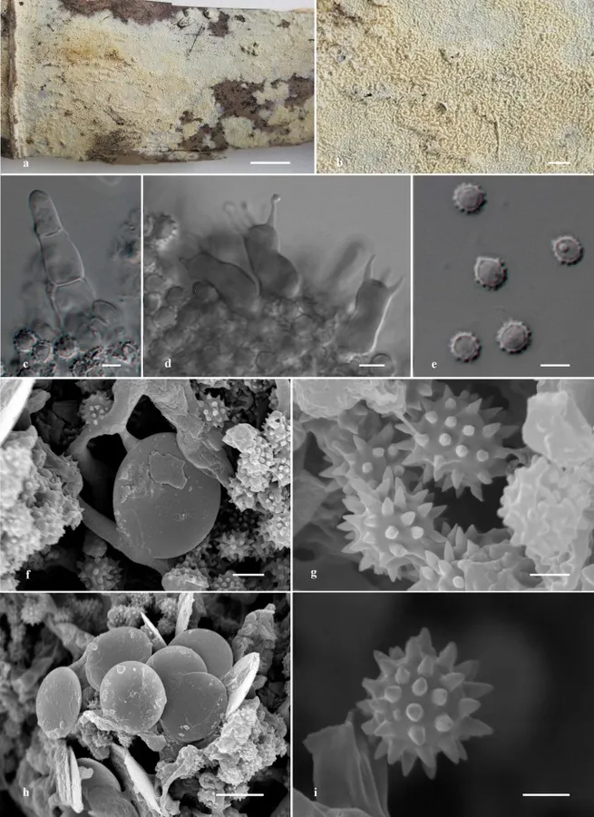 Dokumentasi Trechispora echinospora — Pelat ilmiah