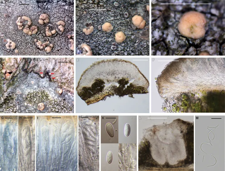 Dokumentasi Lecanora parasymmicta — Pelat ilmiah