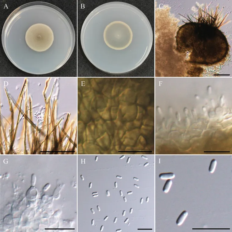Dokumentasi Setophaeosphaeria microspora — Pelat ilmiah