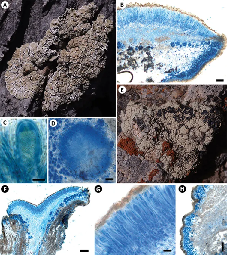 Dokumentasi Rhizoplaca callichroa — Pelat ilmiah