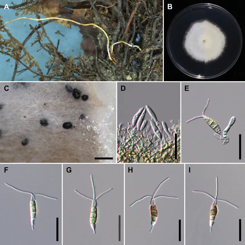 Dokumentasi Neopestalotiopsis haikouensis — Pelat ilmiah