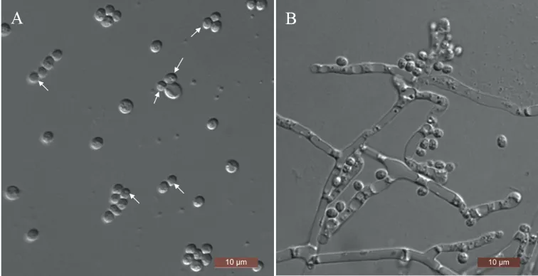Dokumentasi Zygoascus detingensis — Pelat ilmiah