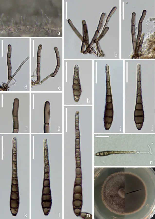 Dokumentasi Distoseptispora euseptata — Pelat ilmiah