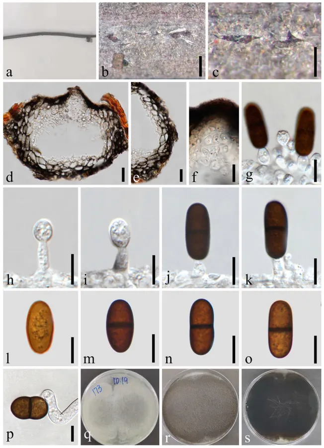Dokumentasi Dothiorella septata — Pelat ilmiah