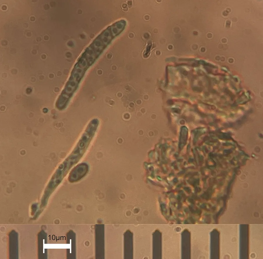 Dokumentasi Calicium glaucellum — Fotografi