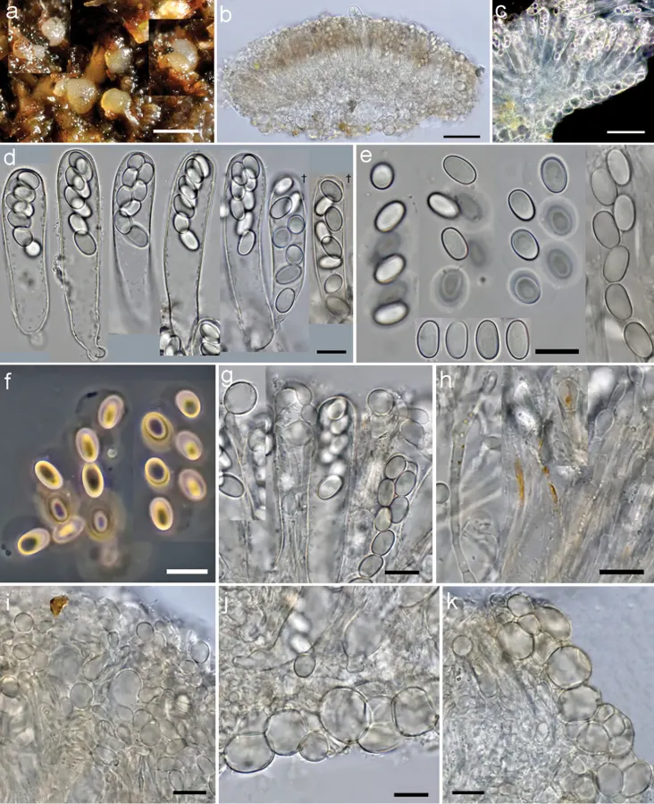 Dokumentasi Coprotus epithecioides — Pelat ilmiah