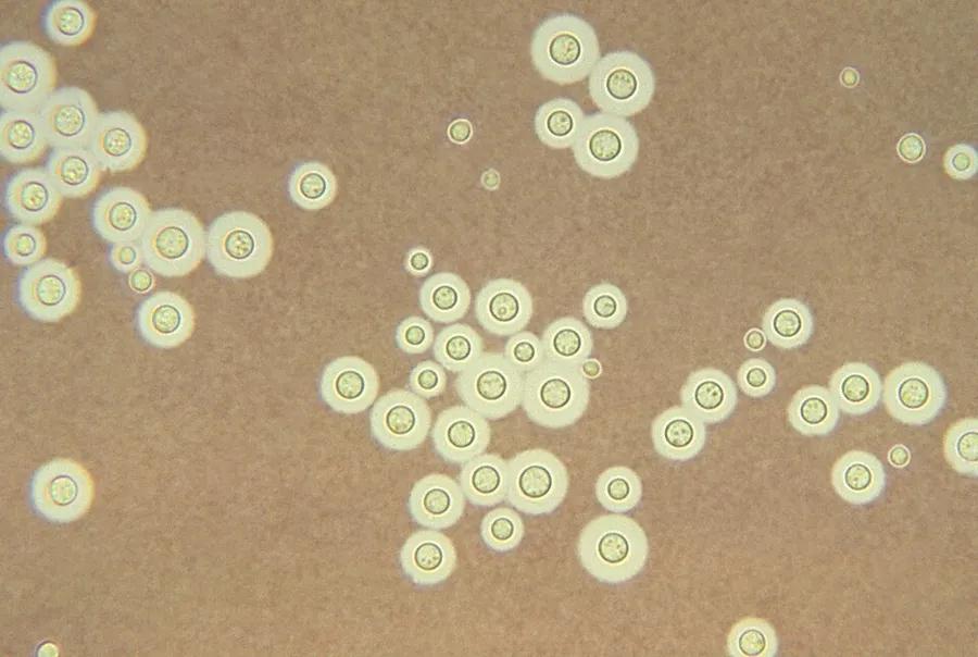 Dokumentasi Cryptococcus neoformans — Fotografi