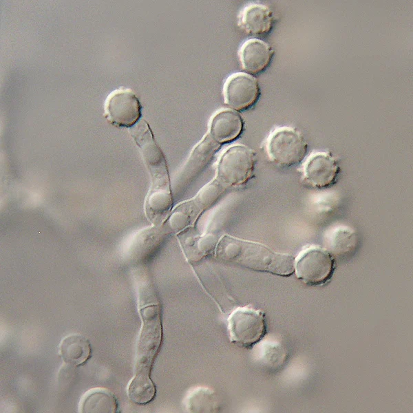 Mikrograf struktur Microascus brevicaulis, dicatat sebagai Scopulariopsis brevicaulis