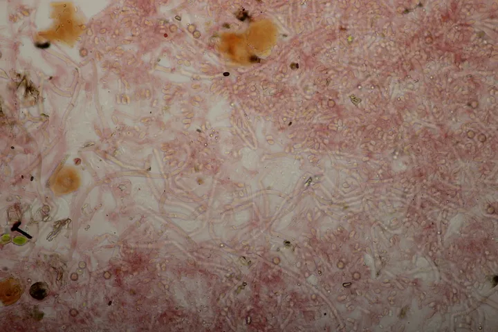 Foto yang diasosiasikan dengan Sistotrema coroniferum pada iNaturalist