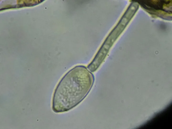 Mikrograf konidium dan struktur pembentuknya, diasosiasikan dengan Ramularia rubella oleh sumber