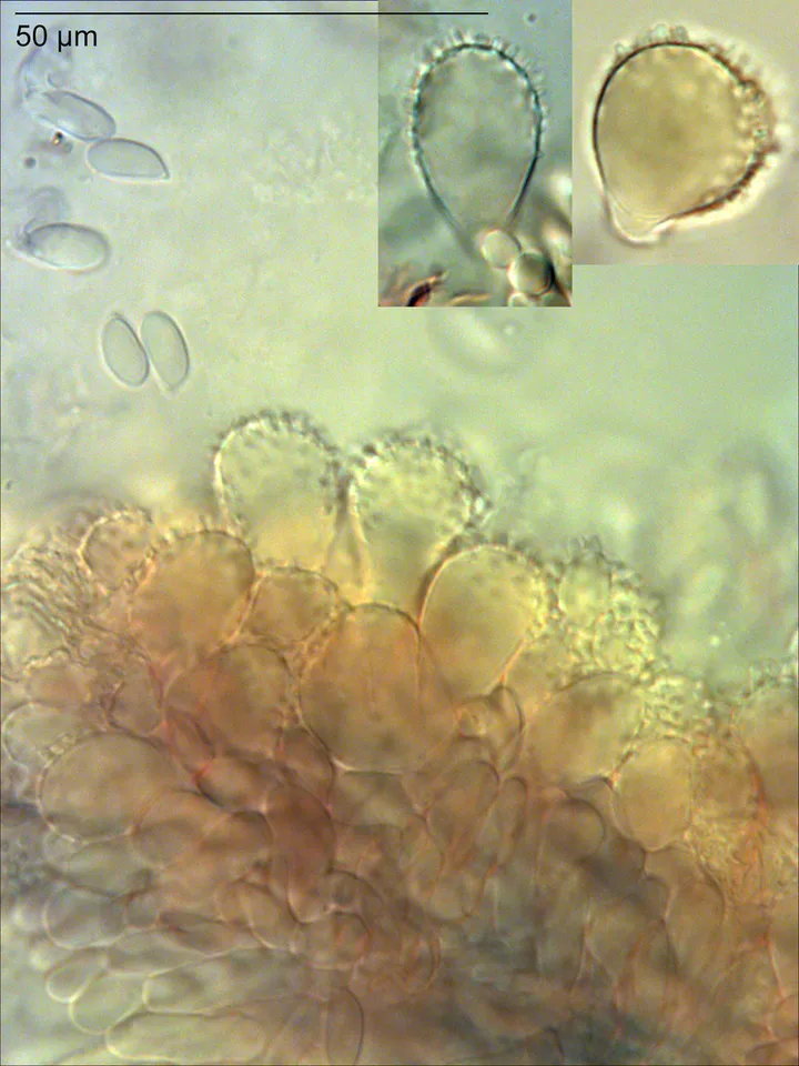Pelat mikroskopis spora dan jaringan yang diasosiasikan dengan Mycena metata oleh sumber