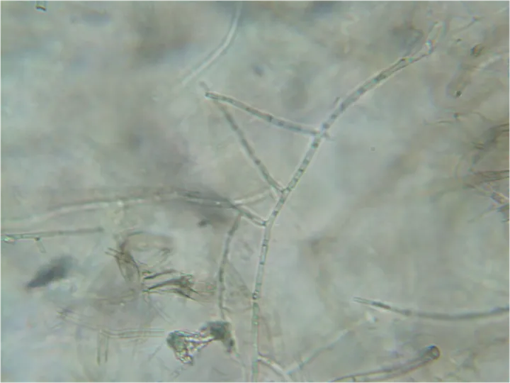 Foto yang diasosiasikan dengan Rhizoctonia solani pada iNaturalist