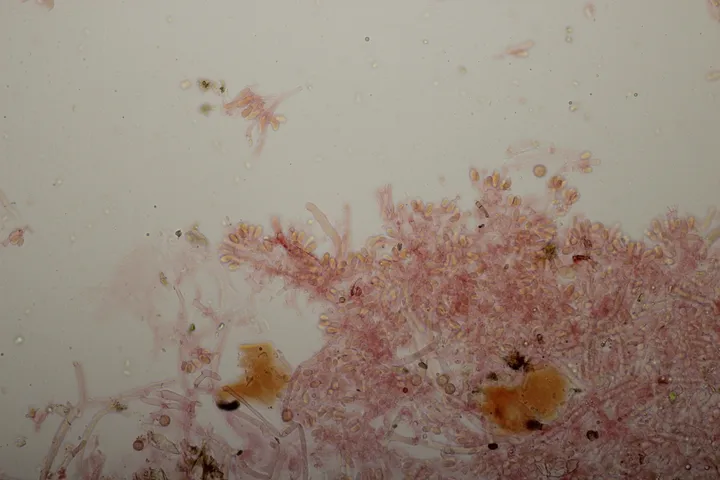Foto yang diasosiasikan dengan Sistotrema coroniferum pada iNaturalist