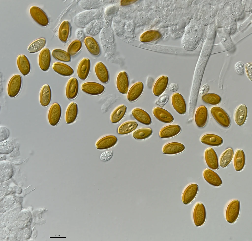 Mikrograf struktur yang diasosiasikan dengan Leratiomyces squamosus pada iNaturalist