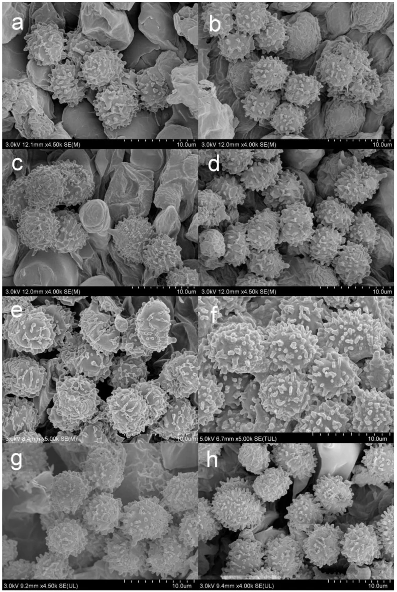 Mikrograf SEM basidiospora Russula gracillima pada panel b; panel lain menunjukkan spesies Russula pembanding.