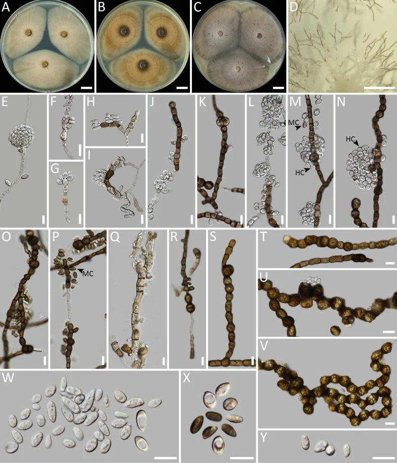 Pelat ilmiah Aureobasidium melanogenum menurut sumber