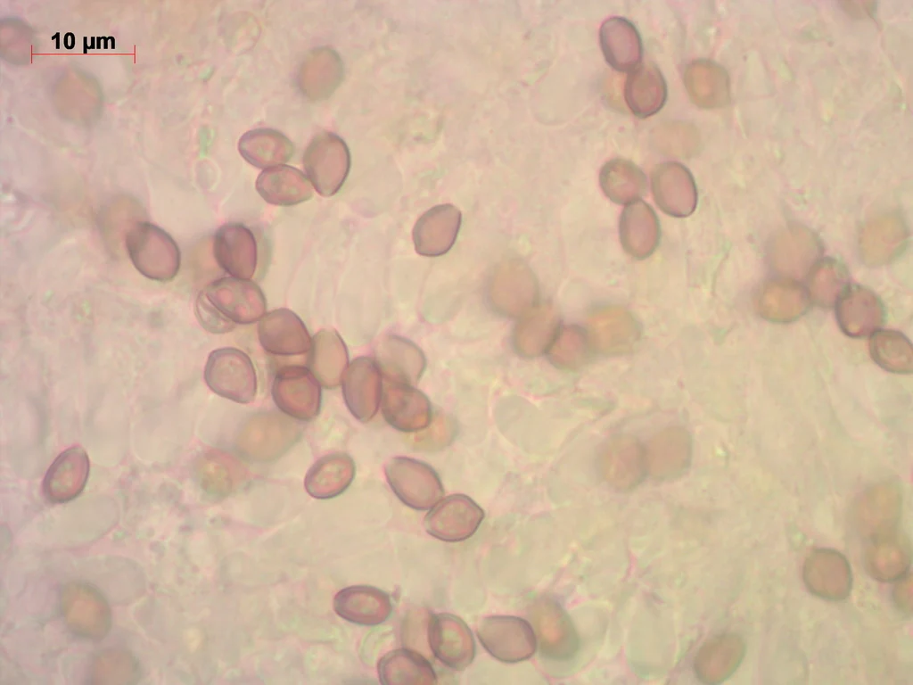 Mikrograf struktur yang diasosiasikan dengan Deconica phyllogena pada iNaturalist